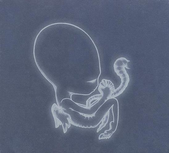 Sigur Rós – Ágætis Byrjun
